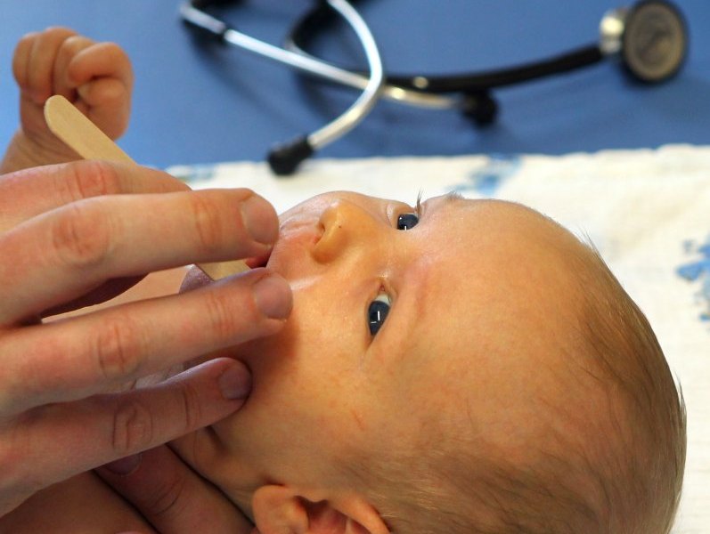 baby-herpes.jpg