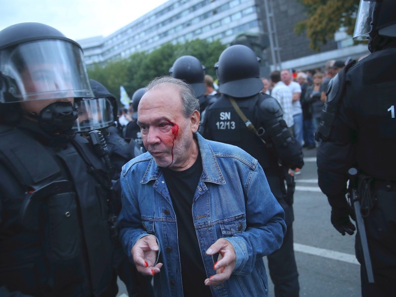 Die Polizei eskortiert einen verletzten Teilnehmer.