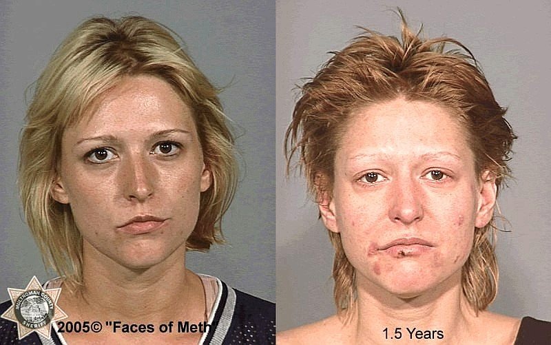 faces-of-meth-2005-f18~3d8fec39-0952-4640-986f-0632a8c9a051.jpg