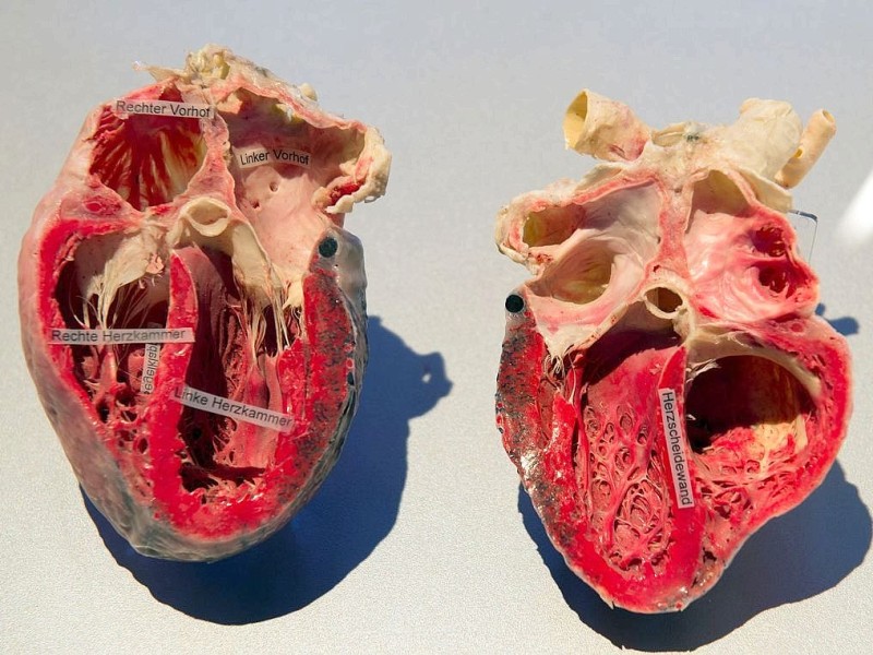 Die Themenausstellung Körperwelten und der Zyklus des Lebens mit Plastinaten des menschlichen Körpers ist erstmals im Ruhrgebiet zu sehen, in Bochum an der Hermannshöhe, am Donnerstag, den 29. August  2013 in Bochum.  Foto: Ingo Otto / WAZ FotoPool