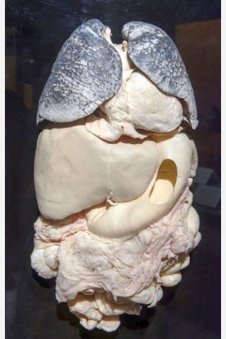 Die Themenausstellung Körperwelten und der Zyklus des Lebens mit Plastinaten des menschlichen Körpers ist erstmals im Ruhrgebiet zu sehen, in Bochum an der Hermannshöhe, am Donnerstag, den 29. August  2013 in Bochum. Raucherlunge.  Foto: Ingo Otto / WAZ FotoPool