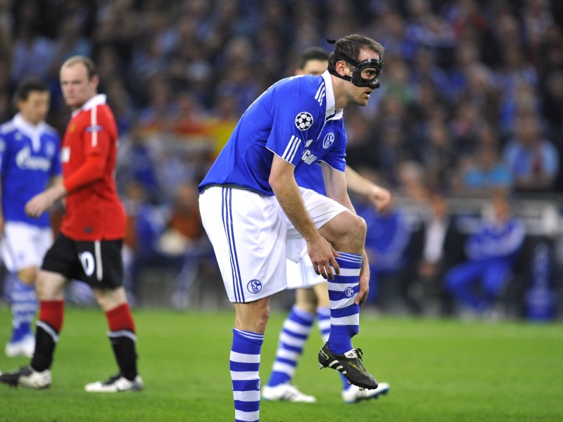 Das Champions-League-Halbfinal-Spiel gegen Manchester United wollte sich Christoph Metzelder 2011 trotz Nasenbeinbruch nicht entgehen lassen. Half leider nichts: das Heimspiel ging 0:2 verloren.