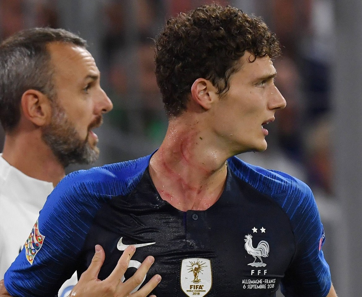 Pavard hatte heftige Striemen am Hals.